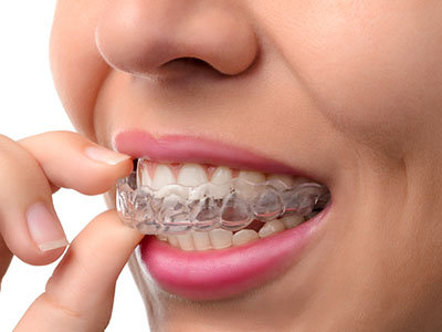 Bethesda Rock Dental | Ceramic Crowns, Simple Extractions and Preventative Program