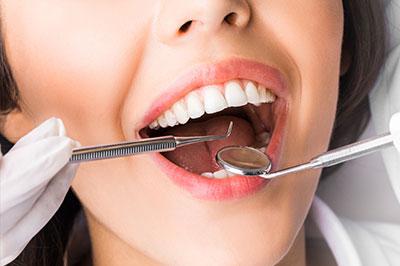 Bethesda Rock Dental | Invisalign reg , iTero reg Intraoral Scanner and Teeth Whitening