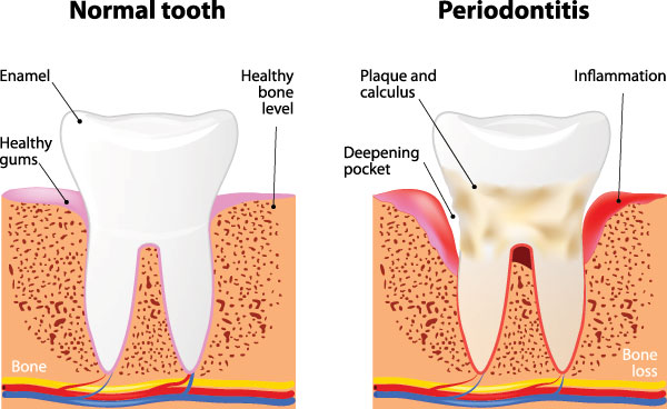 Bethesda Rock Dental | Cosmetic Dentistry, Invisalign reg  and Dental Fillings