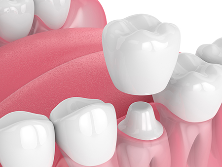 Bethesda Rock Dental